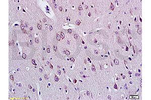 Formalin-fixed and paraffin embedded rat brain tissue labeled with Anti-E2F1 Polyclonal Antibody (ABIN670686), Unconjugated at 1:200, followed by conjugation to the secondary antibody and DAB staining