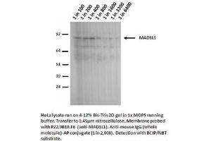 Image no. 2 for anti-Proteasome (Prosome, Macropain) 26S Subunit, Non-ATPase, 14 (PSMD14) antibody (ABIN108607) (PSMD14 antibody)