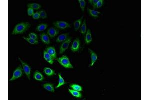 Immunofluorescent analysis of Hela cells using ABIN7156679 at dilution of 1:100 and Alexa Fluor 488-congugated AffiniPure Goat Anti-Rabbit IgG(H+L) (IFITM1 antibody  (AA 1-36))