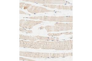 Immunohistochemical analysis of paraffin-embedded human skeletal muscle tissue using C performed on the Leica® BOND RXm. (Glucosylceramidase antibody  (Center))