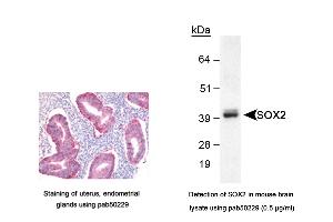 Image no. 3 for anti-SRY (Sex Determining Region Y)-Box 2 (SOX2) (AA 1-100), (N-Term) antibody (ABIN363538) (SOX2 antibody  (N-Term))