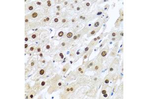 Immunohistochemistry of paraffin-embedded human liver using METTL3 antibody.