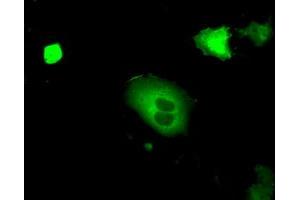 Anti-PRKG1 mouse monoclonal antibody (ABIN2453516) immunofluorescent staining of COS7 cells transiently transfected by pCMV6-ENTRY PRKG1 (RC220986). (PRKG1 antibody)