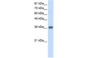 KLHDC8A antibody used at 1. (KLHDC8A antibody  (C-Term))