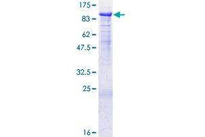 Image no. 1 for Protein S (PROS) (AA 1-676) protein (GST tag) (ABIN1316368) (PROS1 Protein (AA 1-676) (GST tag))