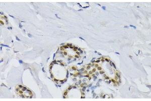 Immunohistochemistry of paraffin-embedded Human breast using BCCIP Polyclonal Antibody at dilution of 1:100 (40x lens).