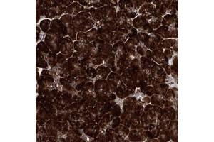 Immunohistochemical staining of human pancreas with MSANTD2 polyclonal antibody  shows strong cytoplasmic positivity in exocrine glandular cells at 1:50-1:200 dilution. (MSANTD2 antibody)