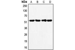 Western blot analysis of p53 expression in MDAMB231 (A), HepG2 (B), MCF7 (C), A431 (D) whole cell lysates.