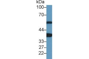 Western Blot; Sample: Rat Heart lysate; Primary Ab: 1µg/ml Rabbit Anti-Mouse ANKRD1 Antibody Second Ab: 0. (ANKRD1 antibody  (AA 1-319))