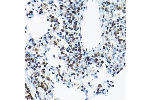 Immunohistochemistry (IHC) image for anti-Small Nuclear Ribonucleoprotein Polypeptide A (SNRPA) (AA 1-220) antibody (ABIN6148212)