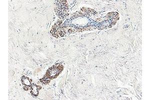 Immunohistochemistry (Paraffin-embedded Sections) (IHC (p)) image for anti-serpin Peptidase Inhibitor, Clade B (Ovalbumin), Member 5 (SERPINB5) antibody (ABIN487960)