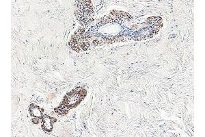 Formalin-Fixed Paraffin-Embedded Sections of Human normal breast in situ using Maspin Antibody Cat. (SERPINB5 antibody)