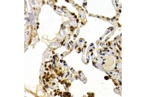 Immunohistochemistry of paraffin-embedded human lung using TFDP1 antibody (ABIN5973148) at dilution of 1/200 (40x lens). (DP1 antibody)