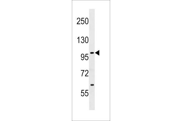 SIK1 antibody  (C-Term)