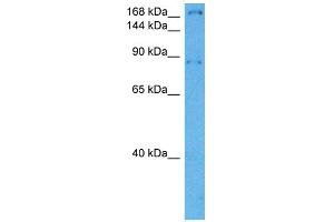 Host:  Rabbit  Target Name:  LAMB1  Sample Tissue:  Mouse Heart  Antibody Dilution:  1ug/ml (Laminin beta 1 antibody  (Middle Region))