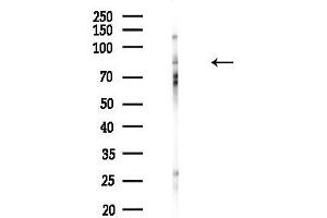 anti-Hyperpolarization Activated Cyclic Nucleotide-Gated Potassium Channel 3 (HCN3) (C-Term) antibody