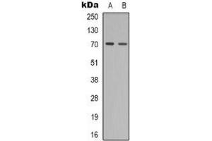 Western blot analysis of ZAP70 (pY319) expression in SHSY5Y (A), Jurkat (B) whole cell lysates.