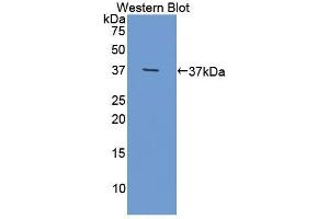 Detection of Recombinant OLFM4, Mouse using Polyclonal Antibody to Olfactomedin 4 (OLFM4) (Olfactomedin 4 antibody  (AA 238-500))