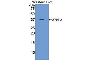 Olfactomedin 4 anticorps  (AA 238-500)