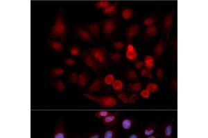 Immunofluorescence analysis of MCF-7 cells using Phospho-ABL1(Y412) Polyclonal Antibody (ABL1 antibody  (pTyr412))