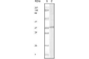 Western blot analysis using KSHV ORF62 mouse mAb against KSHV ORF62 recombinant protein. (KSHVORF62 antibody)