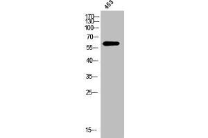 Western Blot analysis of 453 cells using OPN Polyclonal Antibody (Osteopontin antibody  (C-Term))