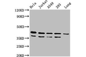 Western Blot Positive WB detected in: Hela whole cell lysate, Jurkat whole cell lysate, A549 whole cell lysate, 293 whole cell lysate, Rat lung tissue All lanes: MAPK1 antibody at 4. (ERK2 antibody  (AA 310-360))
