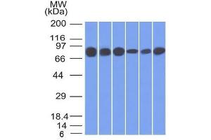 Western Blot of HT20, 293, A431, MCF-7, HepG2 and A549 cell lysates using Catenin, gamma Mouse Monoclonal Antibody (15F11). (JUP antibody)