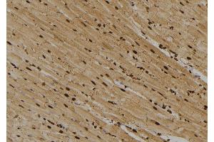 ABIN6273670 at 1/100 staining Rat heart tissue by IHC-P. (ITGA2 antibody  (C-Term))