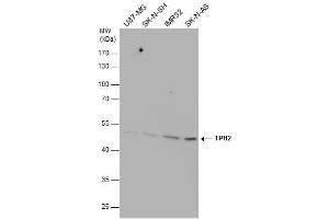 WB Image TPH2 antibody detects TPH2 protein by western blot analysis. (Tryptophan Hydroxylase 2 antibody)