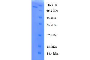 SDS-PAGE (SDS) image for Galactosamine (N-Acetyl)-6-Sulfate Sulfatase (GALNS) (AA 27-522) protein (GST tag) (ABIN5709553)