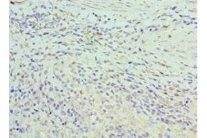 Immunohistochemistry of paraffin-embedded human epityphlon tissue using ABIN7155295 at dilution of 1:100