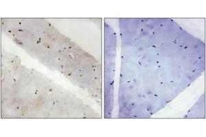 Immunohistochemistry analysis of paraffin-embedded human skeletal muscle tissue, using LATS2 Antibody. (LATS2 antibody  (AA 541-590))