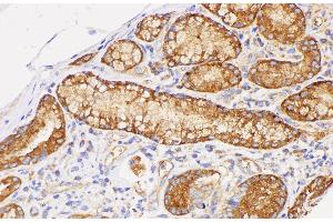 Immunohistochemistry of paraffin-embedded Human duodenum using CD38 Polycloanl Antibody at dilution of 1:200