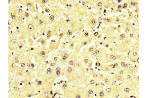 IHC image of ABIN7143616 diluted at 1:350 and staining in paraffin-embedded human liver tissue performed on a Leica BondTM system. (ALT antibody  (AA 2-496))