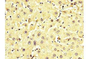 IHC image of ABIN7143616 diluted at 1:350 and staining in paraffin-embedded human liver tissue performed on a Leica BondTM system. (ALT antibody  (AA 2-496))