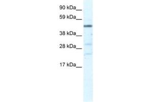 Western Blotting (WB) image for anti-Heat Shock Transcription Factor, Y-Linked 1 (HSFY1) antibody (ABIN2461287) (HSFY1 antibody)