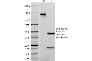 SDS-PAGE Analysis Purified TACSTD2 / TROP2 Mouse Monoclonal Antibody (TACSTD2/2152). (TACSTD2 antibody  (AA 31-274))
