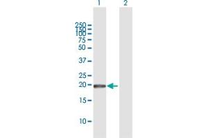 Western Blot analysis of GUK1 expression in transfected 293T cell line by GUK1 MaxPab polyclonal antibody. (GUK1 antibody  (AA 1-197))