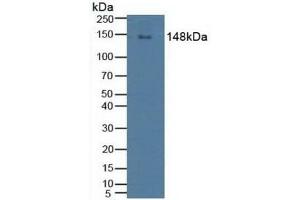 Detection of PLCg2 in Human Raji Cells using Polyclonal Antibody to Phospholipase C Gamma 2, Phosphatidylinositol Specific (PLCg2) (Phospholipase C gamma 2 antibody  (AA 930-1152))