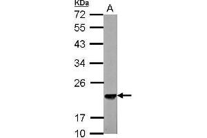 WB Image Sample (30 ug of whole cell lysate) A: NIH-3T3 12% SDS PAGE antibody diluted at 1:3000 (SKP1 antibody)