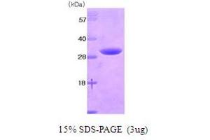 SDS-PAGE (SDS) image for 14-3-3 eta (YWHAH) (AA 1-246) protein (His tag) (ABIN667061)
