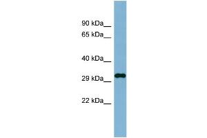 WB Suggested Anti-C20orf116 Antibody Titration:  0. (DDRGK1 antibody  (N-Term))