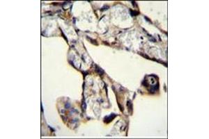 Immunohistochemistry analysis in Formalin Fixed, Paraffin Embedded Human placenta tissue stained with SASH1 Antibody (N-term) followed by peroxidase conjugation of the secondary antibody and DAB staining. (SASH1 antibody  (Middle Region))
