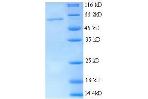 SDS-PAGE (SDS) image for Thrombospondin 3 (THBS3) (AA 24-350), (partial) protein (His tag) (ABIN4976870)