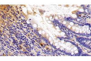 Detection of SIRT3 in Rat Colon Tissue using Polyclonal Antibody to Sirtuin 3 (SIRT3) (SIRT3 antibody  (AA 127-303))