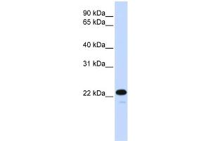 WB Suggested Anti-CDKN1B Antibody Titration:  0. (CDKN1B antibody  (C-Term))