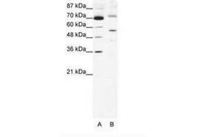 Image no. 1 for anti-Sirtuin 3 (SIRT3) (AA 152-201) antibody (ABIN203108)