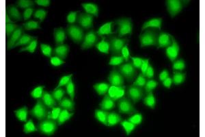 Immunofluorescence analysis of HeLa cells using DNASE1 antibody (ABIN5971366). (DNASE1 antibody)