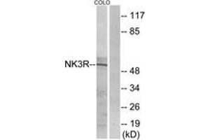 Western blot analysis of extracts from COLO205 cells, using NK3R Antibody.